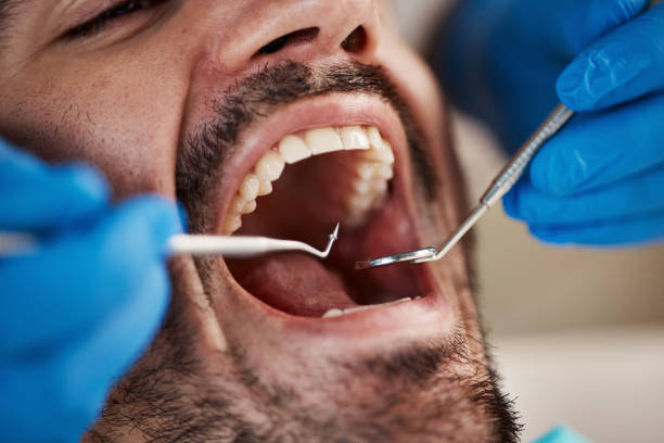 Best Emergency Treatment for Toothache in Great Bend, KS